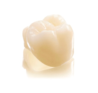 크라운 치아의 종류 및 지르코니아 크라운 치아 깨짐 AS